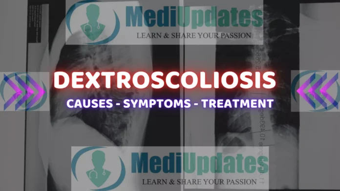 Dextroscoliosis