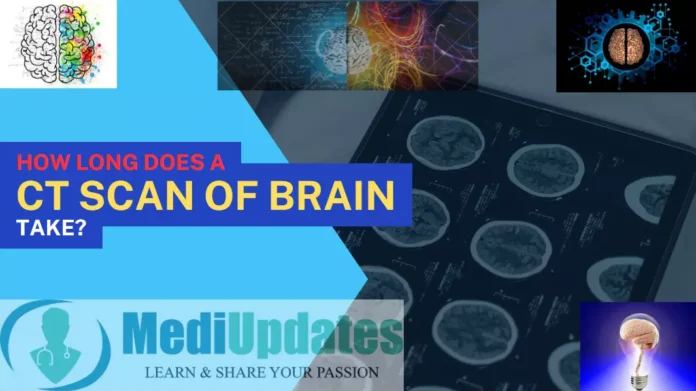 How Long Does a CT Scan of the Brain Take?