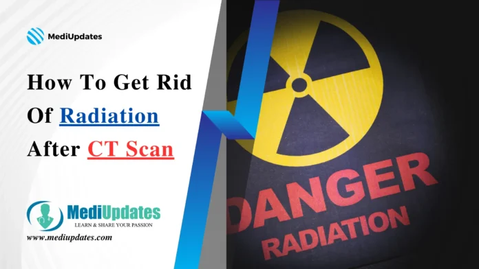 How To Get Rid Of Radiation After CT Scan